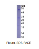 沉默调节蛋白1(SIRT1)重组蛋白