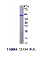 ZW10交互子(ZWINT)重组蛋白