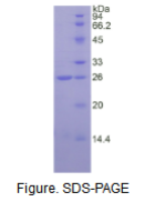儿茶酚-O-甲基转移酶(COMT)活性蛋白
