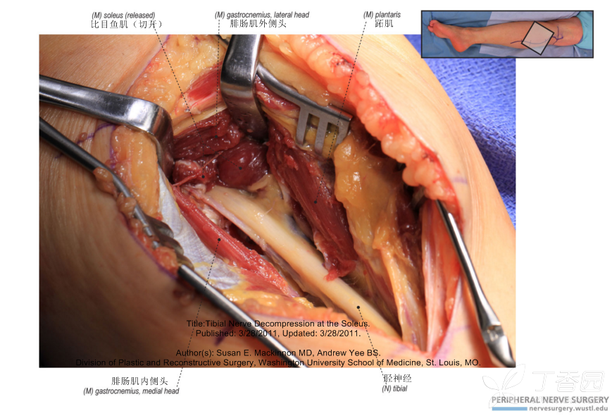 精美图片分享(2)-胫神经
