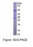 CD5分子(CD5)重组蛋白