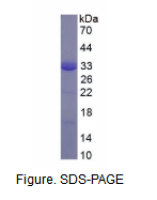 CD200受体1(CD200R1)重组蛋白