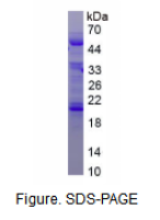 α2-HS糖蛋白(AHSG)重组蛋白