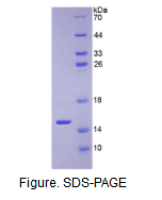 葡萄糖转运蛋白1(GLUT1)重组蛋白