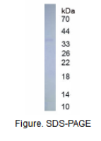 激肽释放酶3(PSA)真核蛋白