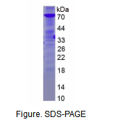 PAI-1/tPA复合物(tPA/PAI1)重组蛋白