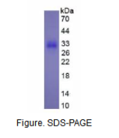 Ⅲ型前胶原氨基端原肽(PIIINP)真核蛋白