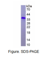 视网膜血管瘤肿瘤抑制因子(vHL)重组蛋白