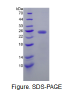 N-乙酰半乳糖胺酶α(NAGa)重组蛋白