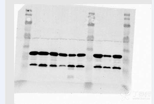 跑wb内参gapdh有两个条带