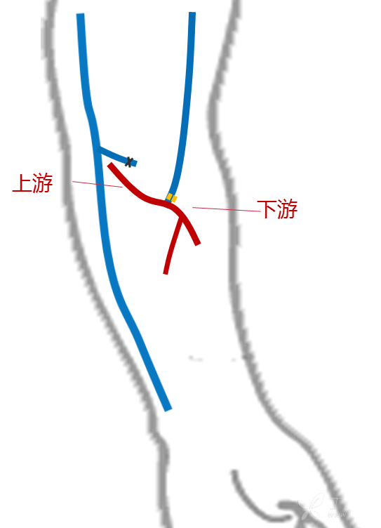 所要注意的是肱动脉的变异,有的肱动脉分成桡,尺动脉的位置很高,在
