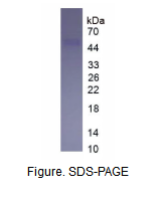 血管内皮生长因子受体1(VEGFR1)真核蛋白