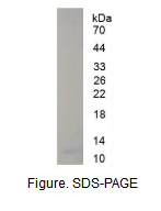 基质细胞衍生因子1(SDF1)真核蛋白