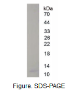 基质细胞衍生因子1(SDF1)真核蛋白