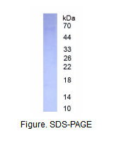 嗜酸性粒细胞过氧化物酶(EPX)真核蛋白