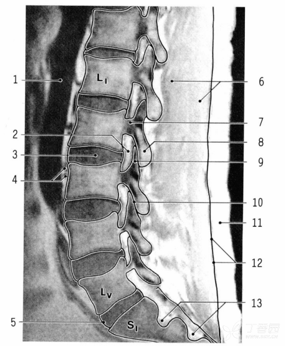 腰椎椎体ct解剖图图片