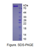 凝血因子Ⅻ(F12)真核蛋白