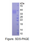 Dickkopf相关蛋白1(DKK1)真核蛋白