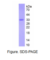 胰岛素样生长因子结合蛋白1(IGFBP1)真核蛋白