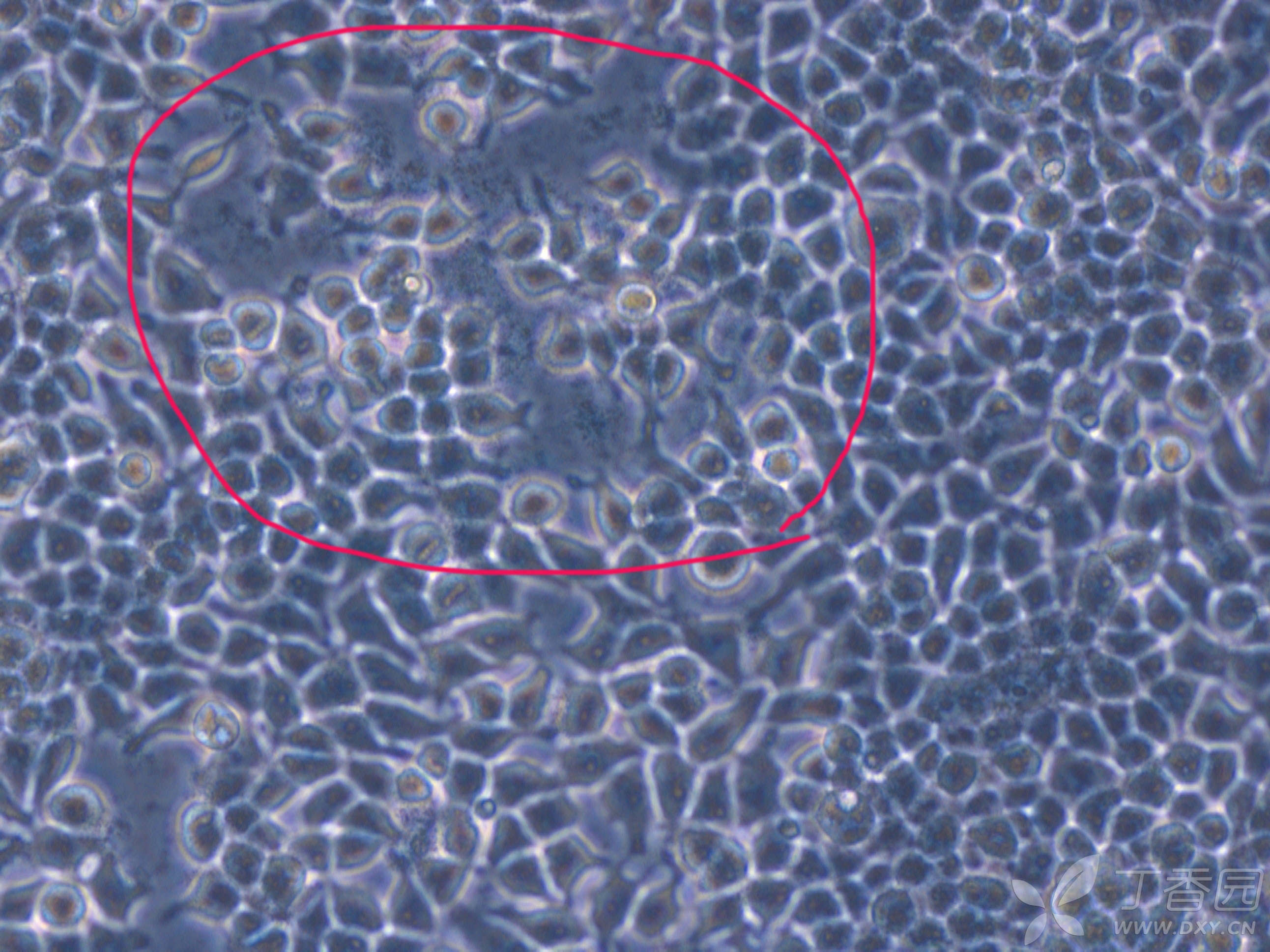 这个是293t细胞呢