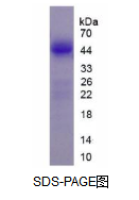 Lemur酪氨酸激酶3(LMTK3)活性蛋白