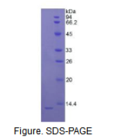 S100钙结合蛋白B(S100B)活性蛋白