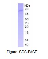 细胞程序性死亡蛋白1配体1(PDL1)活性蛋白