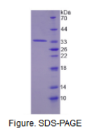 酪氨酸转氨酶(TAT)活性蛋白
