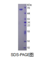 醛脱氢酶1家族成员A1(ALDH1A1)活性蛋白