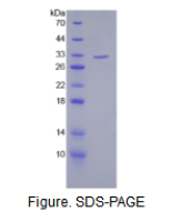 沉默调节蛋白3(SIRT3)活性蛋白