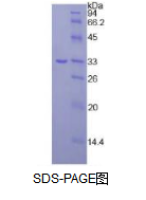 Janus激酶3(JAK3)活性蛋白