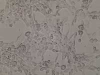 143B 人骨肉瘤细胞,细胞供应