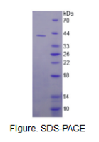 二氢乳清酸脱氢酶(DHODH)活性蛋白