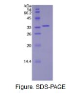 脾脏酪氨酸激酶(SYK)活性蛋白