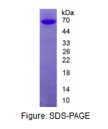 cGMP依赖性蛋白激酶Ⅱ(PRKG2)活性蛋白