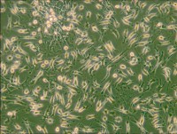 HUVEC-C人脐静脉内皮细胞