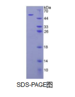 芳基硫酸酯酶B(ARSB)活性蛋白
