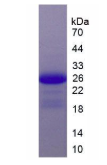 白介素17受体C(IL17RC)活性蛋白