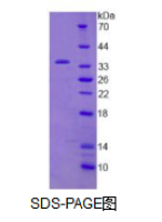 Janus激酶2(JAK2)活性蛋白