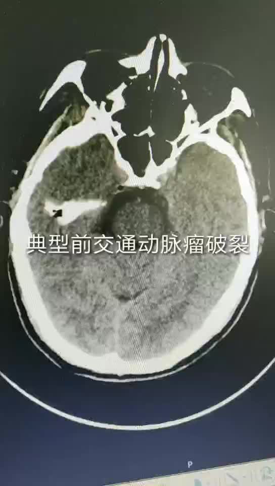 点击可编辑视频封面 preview