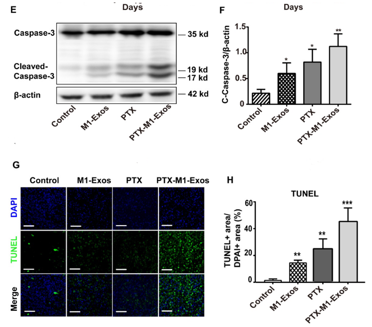 文献解读：超声法进行外泌体载药