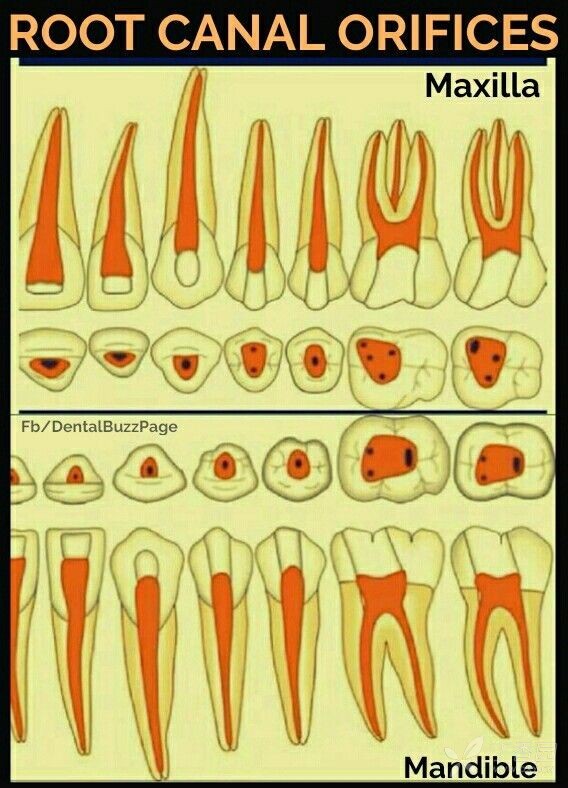 乳牙髓腔根管图解图片