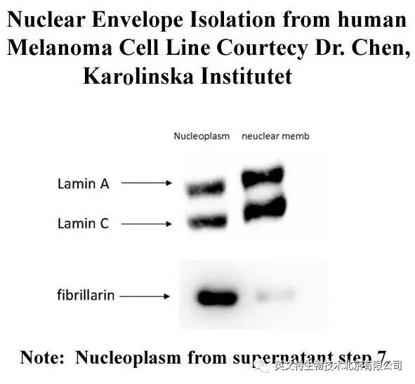 目的蛋白是核蛋白,我该拿它怎么办?