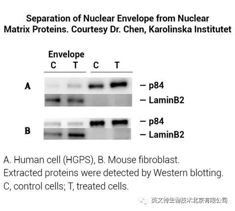 目的蛋白是核蛋白,我该拿它怎么办?