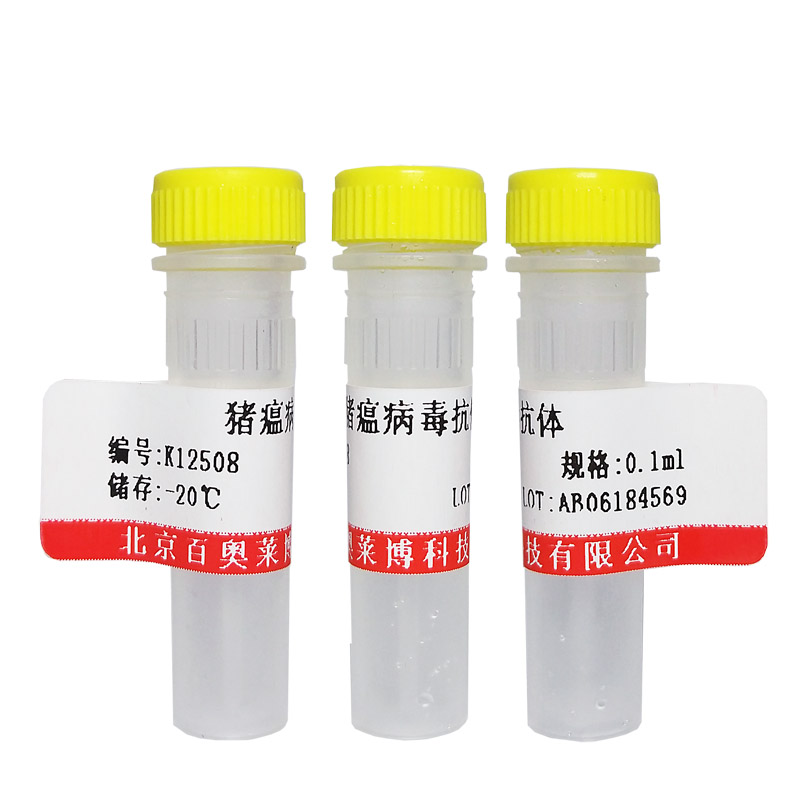 绵羊红细胞溶血素(1:4000)北京厂家