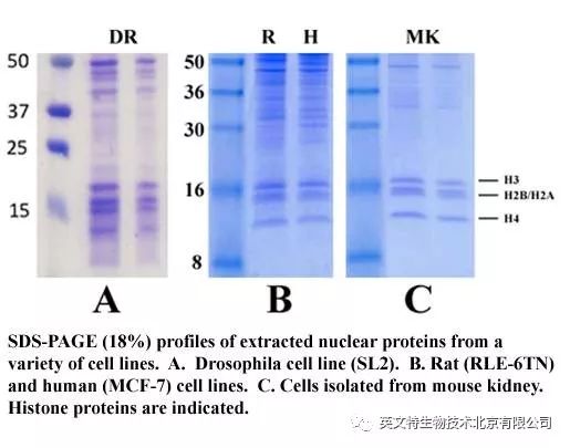 目的蛋白是核蛋白,我该拿它怎么办?