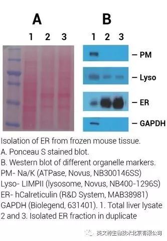 ER-035 Minute™肝脏组织高纯度内质网分离试剂盒-公司新闻-英文特生物技术(北京)有限公司