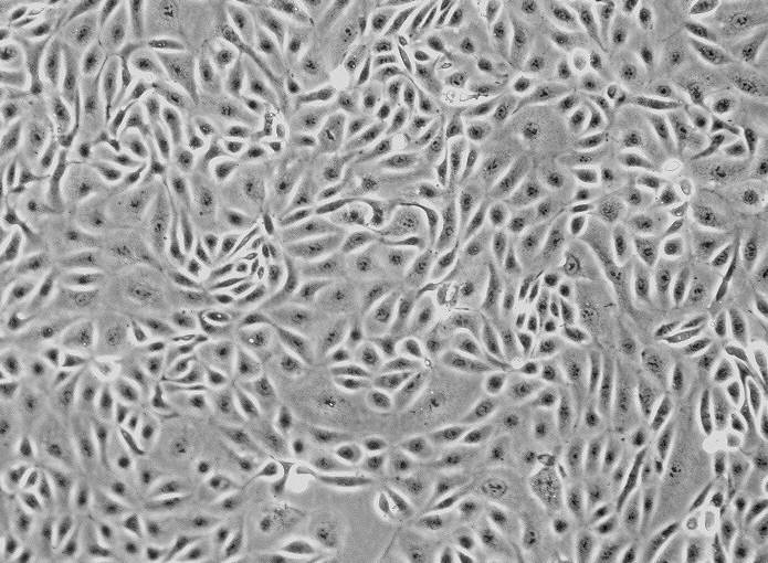 U251 MG人神经胶质瘤细胞