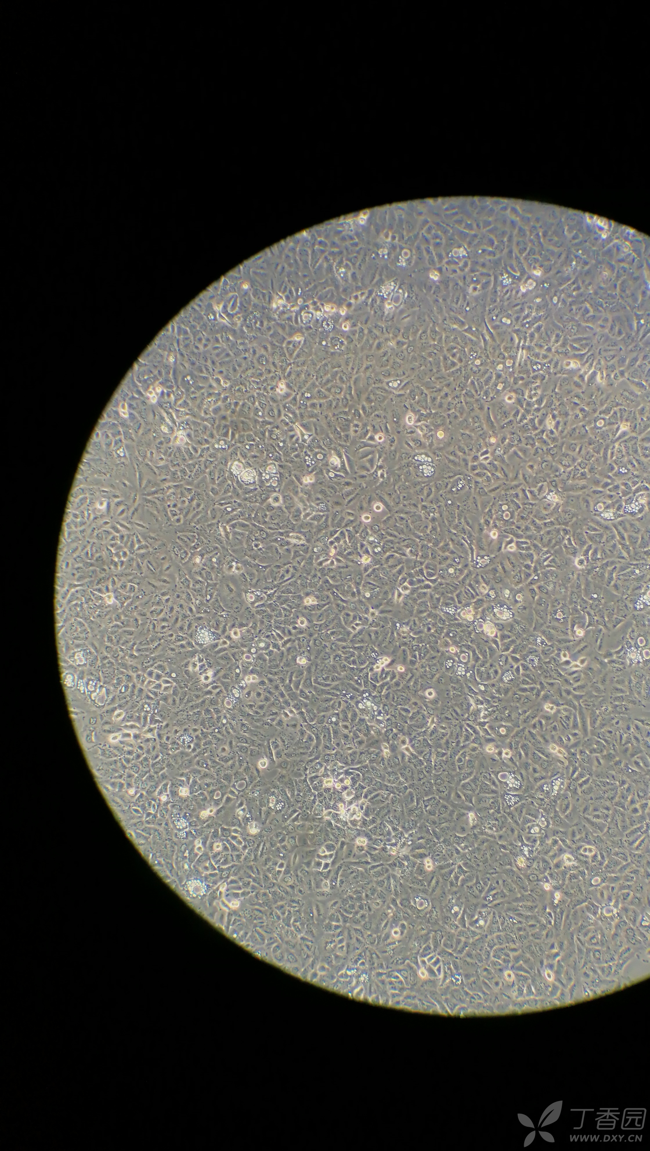 a549细胞,培养的细胞出现空泡,传代后依然存在