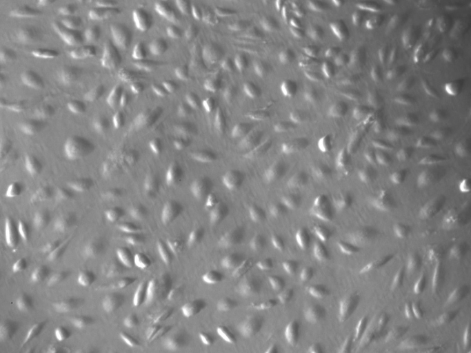 NIT-1小鼠胰岛素瘤β细胞